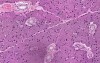 Parotid Gland - Histology