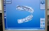 Lunch Date - CEREC AC - e.max Crown #31 Scan and Mill