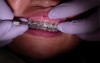 Powerchain - Ortho Update (Patient Mr)