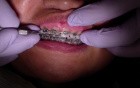 Powerchain - Ortho Update (Patient Mr)