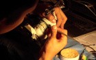 Diagnostic Waxup Part 7