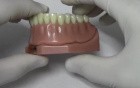 Implant Overdenture - Model Demonstration