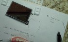 Orthodontic Bracket Placement 101