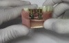 Implant Crown & Bridge - Model Demonstration
