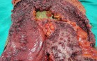 Multiple Rectal Ulcers (95 of 110)