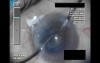 Swollen Conjunctiva - Part 4