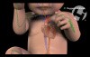 Normal Cerebral Physiology