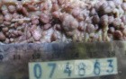 Synchronous Cancers, Familial Adenomatous Polyposis (30 of 36)