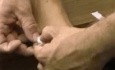 How To Tap Toe Fracture?