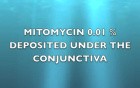 Transciliary Filtration - Vitreoretinal Case