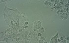 Trichomoniasis - Trichomonas vaginalis - 2