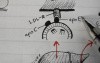 Chylomicron - Lipoprotein Physiology Lecture