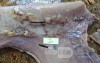 Early Gastric Cancer (15 of 21)