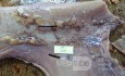 Early Gastric Cancer (15 of 21)