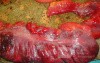 Multiple Rectal Ulcers (81 of 110)