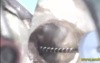 Endodontic cases