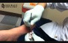 Dr. Jason Knox Drains Gout Lesion from the Foot