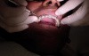 Ortho Patient CC 14 Months Ortho
