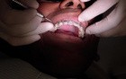 Ortho Patient CC 14 Months Ortho