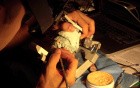 Diagnostic Waxup Part 11