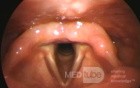The Laryngeal Inlet