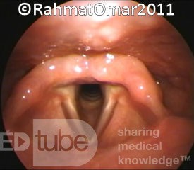 The Laryngeal Inlet