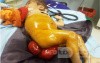 Rectal Prolapse In A Small Child - Other Shot