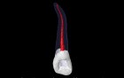 Maxillary Lateral Incisor - Root Canal Anatomy
