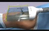 Amerra Healthcare Demo Reel - 3D Medical Animation