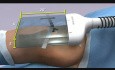Amerra Healthcare Demo Reel - 3D Medical Animation