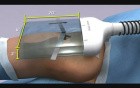 Amerra Healthcare Demo Reel - 3D Medical Animation