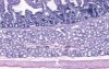 Gastro-Duodenal Junction - Histology