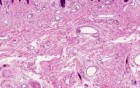 Thick Skin - Histology