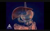 Whipple Procedure - 3D Medical Animation