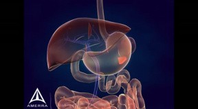 Whipple Procedure - 3D Medical Animation