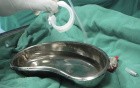 Laparoscopic gastric band