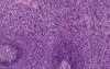 Spleen - Histology