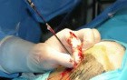Neuronavegador