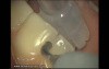Preliminary Visit - Oral Hygiene