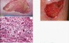 Regeneration and Healing - MSP - 3e