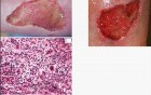 Regeneration and Healing - MSP - 3e