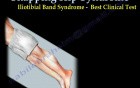 Snapping Hip Syndrome - Video Lecture