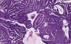 Secretory endometrium