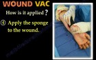 Hemovac Vs. Woundvac 