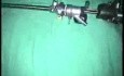 Description Of The Resection Master Resectoscope
