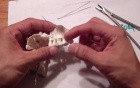 Mandible Fracture - Ivy Loop Fixation - Maxilla Kitchen Table
