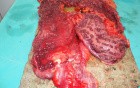 Multiple Rectal Ulcers (91 of 110)