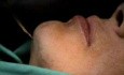 Scarless Chin Enhancement