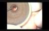 Ear Drainage