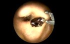 Beetle In The Ear